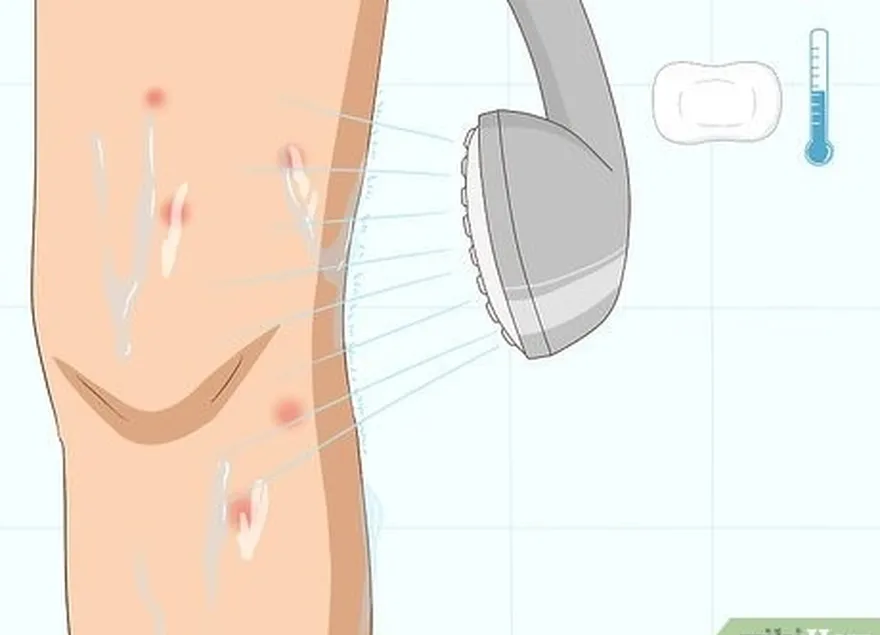 ステップ 1 石鹸と冷水で刺された部分を洗います。