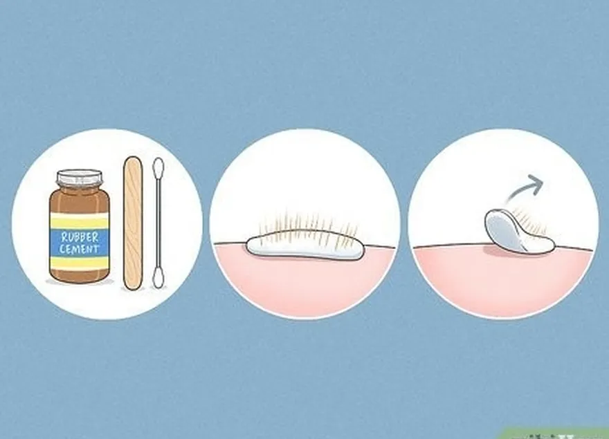 ステップ3ゴムセメントで頑固なサボテンの毛を引き出します。