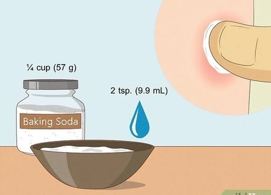 スズメバチの毒液を中和するために、重曹のペーストを作ります。