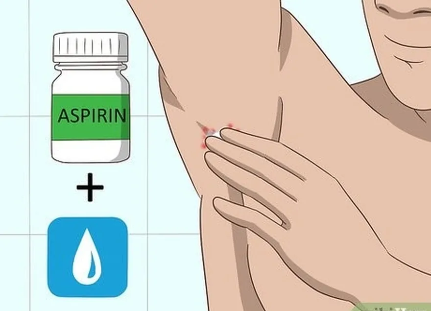 ステップ8他の治療法の代替として、噛みつきに対して濡れたアスピリンを保持します。