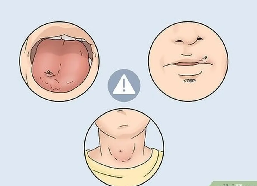 ステップ 2 刺された場所を検討し、刺された場合は助けを求めます。's near an airway.